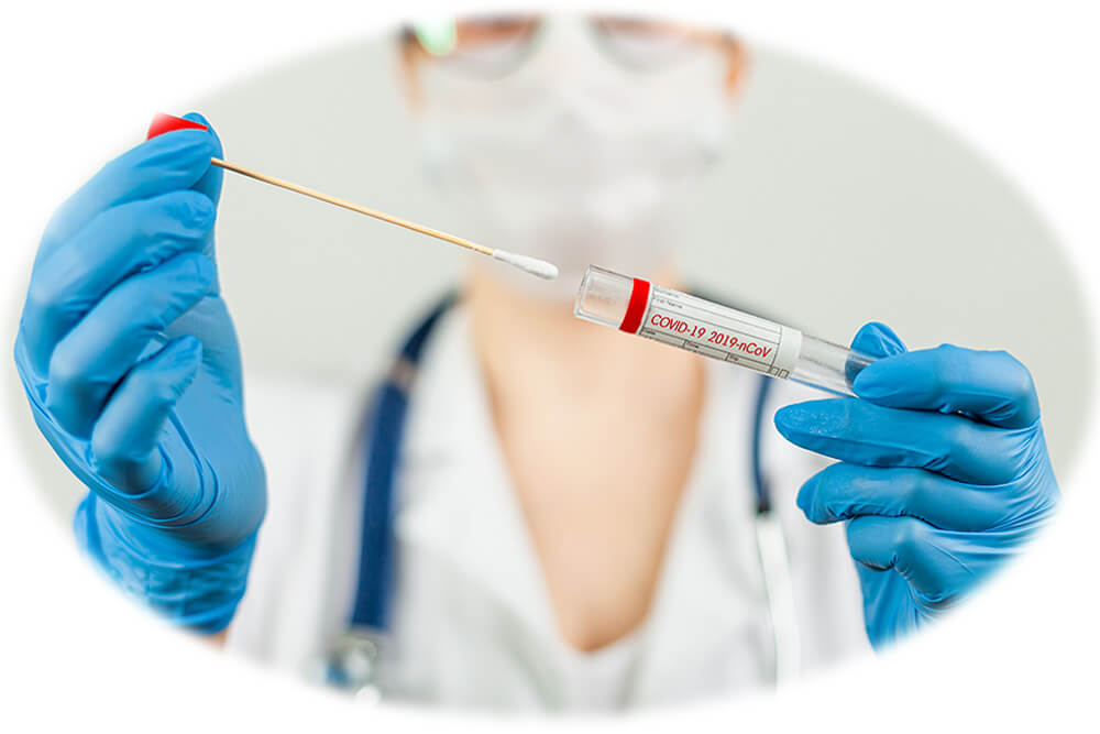 TAMPONE MOLECOLARE EXPRESS MILANO A DOMICILIO