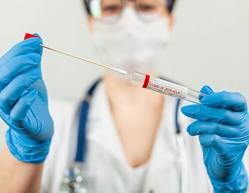 tampone molecolare rapido milano